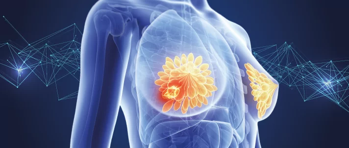 Cancer-Trends-Breast-data