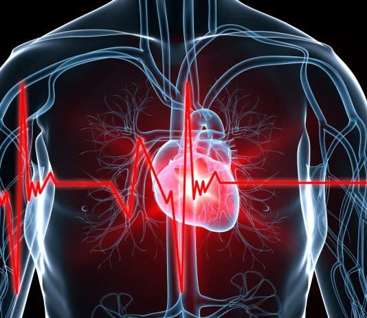 How to Prevent Sudden Cardiac Arrest and Detect Early Signs Cardiac arrest