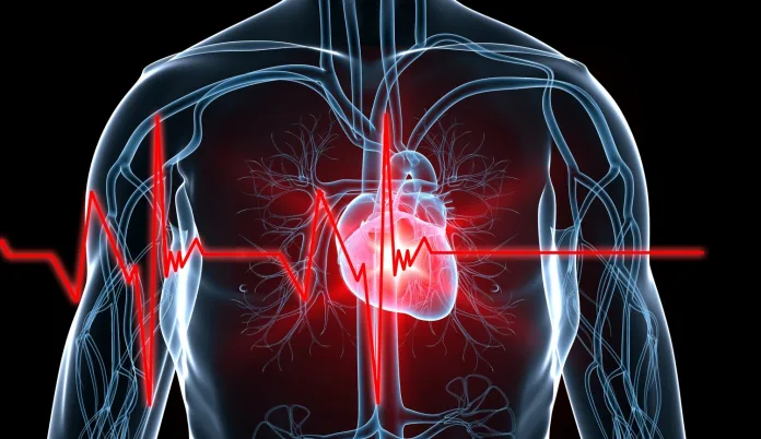Cardiac arrest